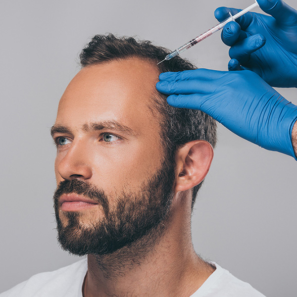 Hair transplantation with PRP