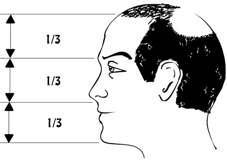 Preparation for hair transplantation